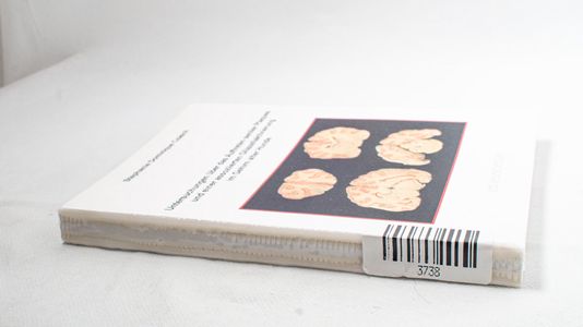 Untersuchungen über das Auftreten seni... Untersuchungen über das Auftreten seni...