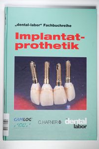 Implantatprothetik: Redaktion Das Dentallabor Implantatprothetik: Redaktion Das Dentallabor