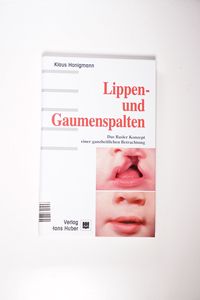 Lippen- und Gaumenspalten: Das Basler Konzept einer ganzheitlichen Betrachtung - Honigmann Klaus